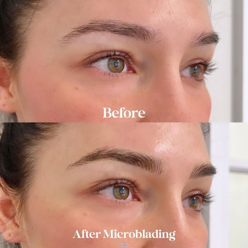 Before and after microblading on woman's eyebrows