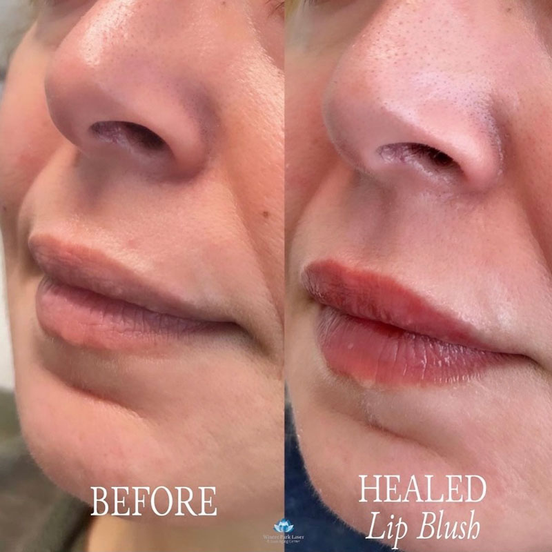 Before and after healed lip blush treatment on woman's lips