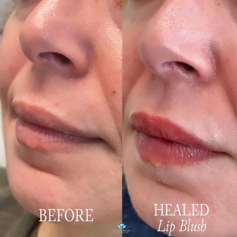 Woman's before and after lip blush treatment in Winter Park, FL