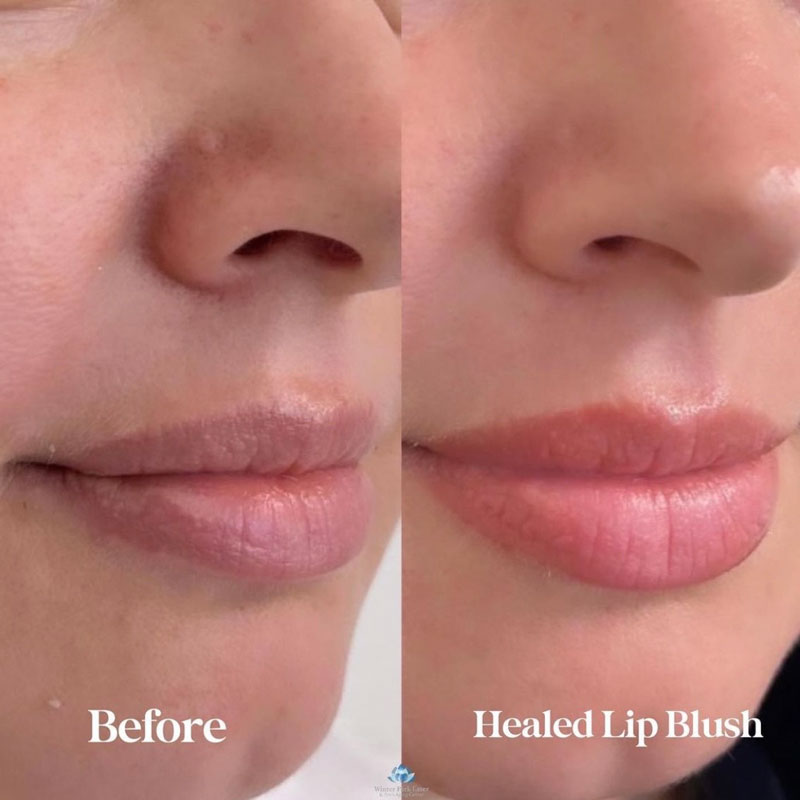 Before and after healed lip blush treatment on woman's lips
