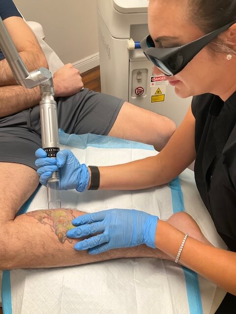 Client receiving tattoo removal treatment