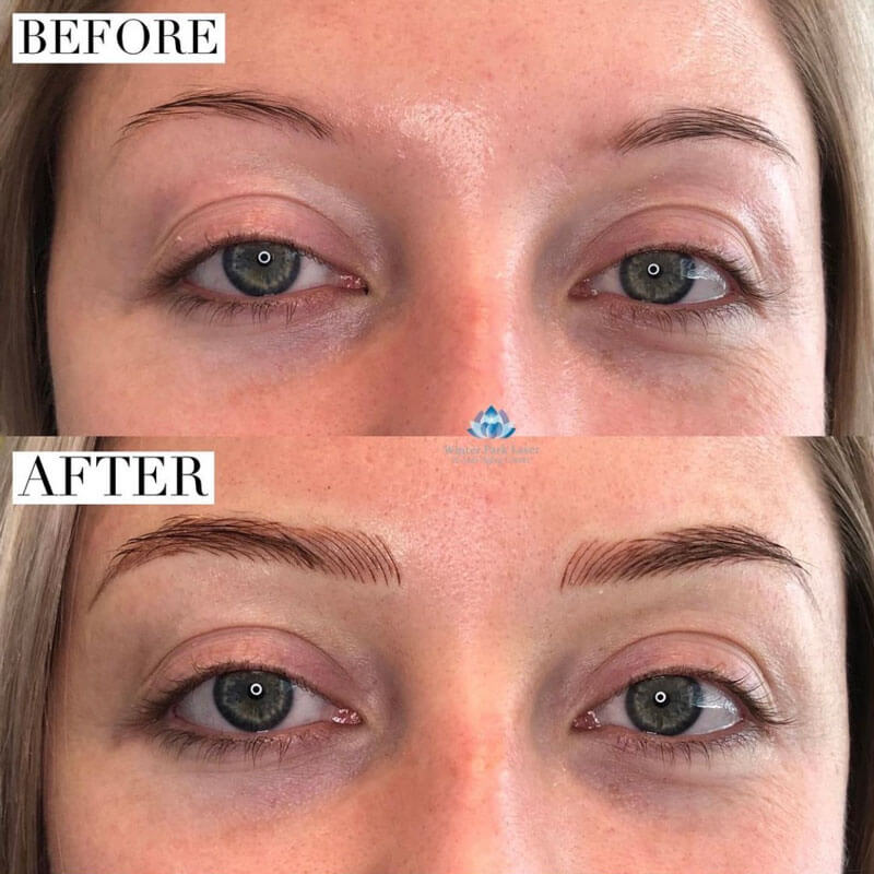 Before and after microblading on woman's eyebrows