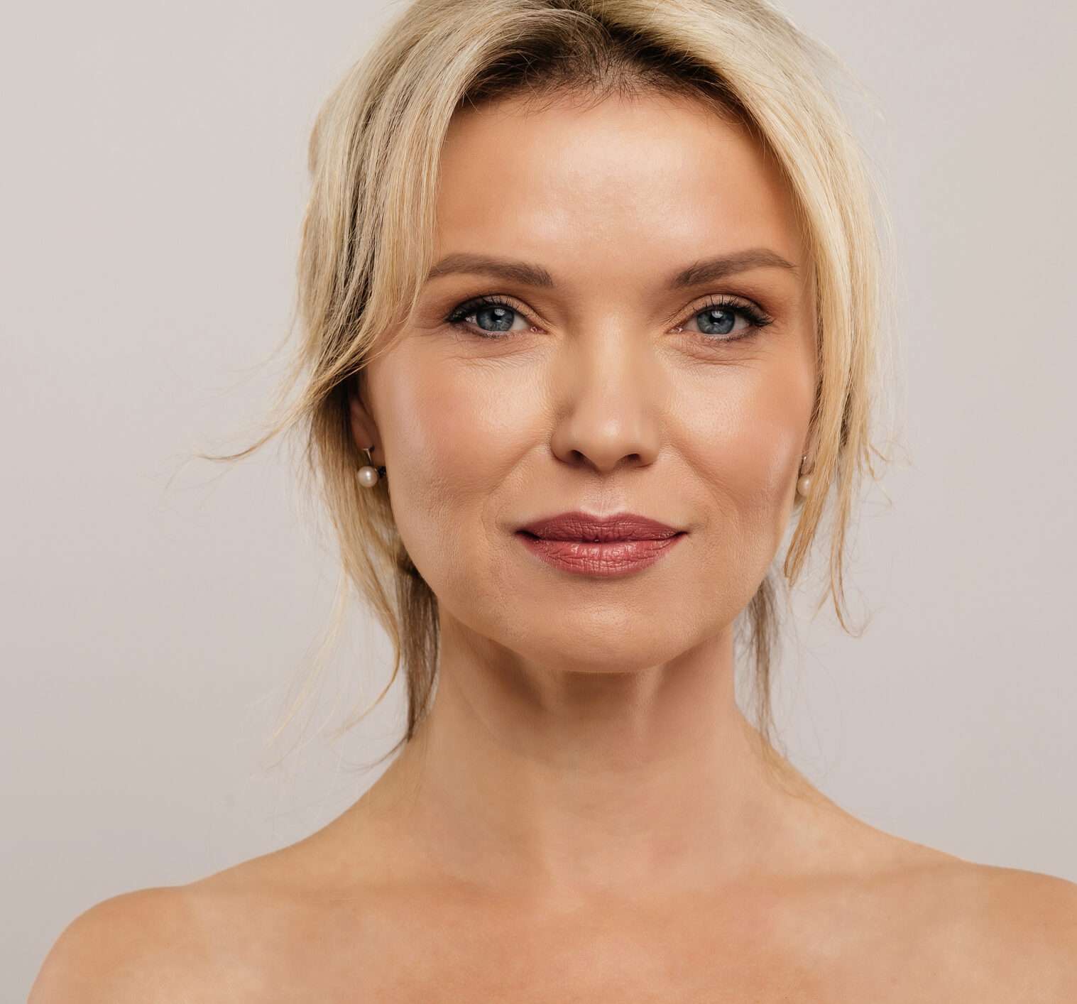 Blonde-haired woman, highlighting after results of wrinkle treatment in Winter Park, FL.